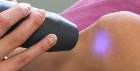 acquelaria laserterapia