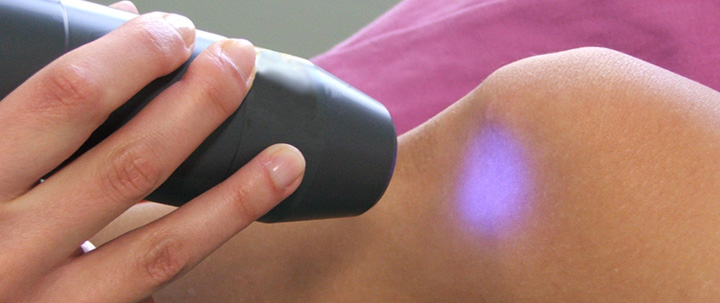 acquelaria laserterapia